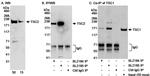 TSC2 Antibody in Western Blot (WB)