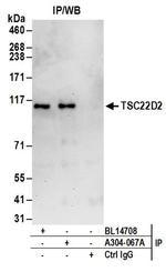 TSC22D2 Antibody in Immunoprecipitation (IP)