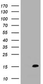 TSC22D3 Antibody in Western Blot (WB)