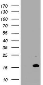 TSC22D3 Antibody in Western Blot (WB)