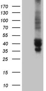 TSC22D4 Antibody in Western Blot (WB)