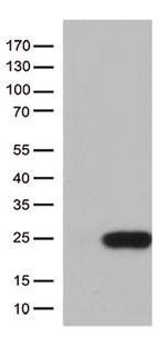 TSEN15 Antibody in Western Blot (WB)