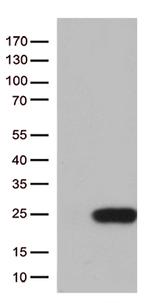 TSEN15 Antibody in Western Blot (WB)