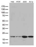 TSEN15 Antibody in Western Blot (WB)