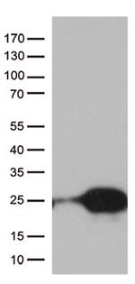 TSEN15 Antibody in Western Blot (WB)