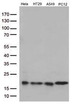 TSEN15 Antibody in Western Blot (WB)