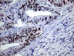 TSEN34 Antibody in Immunohistochemistry (Paraffin) (IHC (P))