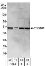 TSG101 Antibody in Western Blot (WB)