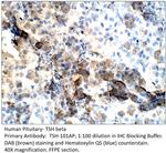 TSH beta Antibody in Immunohistochemistry (IHC)