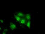 TTC32 Antibody in Immunocytochemistry (ICC/IF)