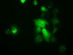 TTC32 Antibody in Immunocytochemistry (ICC/IF)