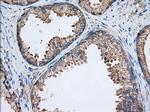 TTC32 Antibody in Immunohistochemistry (Paraffin) (IHC (P))