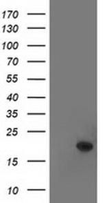 TTC32 Antibody in Western Blot (WB)