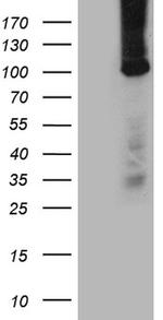 TTC7A Antibody in Western Blot (WB)