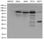 TTC7A Antibody in Western Blot (WB)