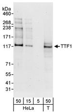 TTF1 Antibody in Western Blot (WB)