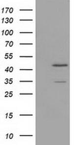 TTL Antibody in Western Blot (WB)