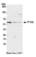 TTYH3 Antibody in Western Blot (WB)