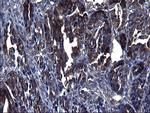 TUBA1A Antibody in Immunohistochemistry (Paraffin) (IHC (P))