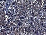 TUBA1A Antibody in Immunohistochemistry (Paraffin) (IHC (P))