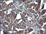 TUBA1A Antibody in Immunohistochemistry (Paraffin) (IHC (P))