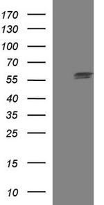 TUBA1A Antibody in Western Blot (WB)