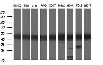 TUBA1A Antibody in Western Blot (WB)