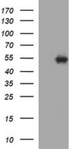 TUBB1 Antibody in Western Blot (WB)