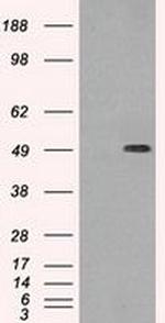 TUBB3 Antibody in Western Blot (WB)