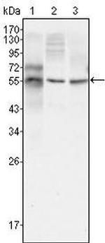 beta-3 Tubulin Antibody in Western Blot (WB)