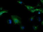 TUBB4 Antibody in Immunocytochemistry (ICC/IF)