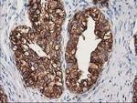 TUBB4 Antibody in Immunohistochemistry (Paraffin) (IHC (P))