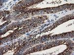 TUBB4 Antibody in Immunohistochemistry (Paraffin) (IHC (P))