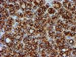 TUBB4 Antibody in Immunohistochemistry (Paraffin) (IHC (P))