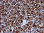 TUBB4 Antibody in Immunohistochemistry (Paraffin) (IHC (P))