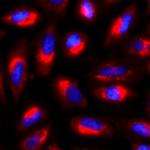 gamma Tubulin Antibody in Immunocytochemistry (ICC/IF)