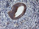 TULP3 Antibody in Immunohistochemistry (Paraffin) (IHC (P))