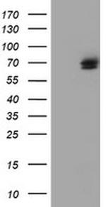 TULP3 Antibody in Western Blot (WB)