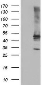 TULP3 Antibody in Western Blot (WB)