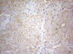 TWF1 Antibody in Immunohistochemistry (Paraffin) (IHC (P))