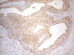 TWF1 Antibody in Immunohistochemistry (Paraffin) (IHC (P))