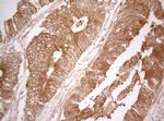 TWF1 Antibody in Immunohistochemistry (Paraffin) (IHC (P))