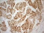 TWF1 Antibody in Immunohistochemistry (Paraffin) (IHC (P))