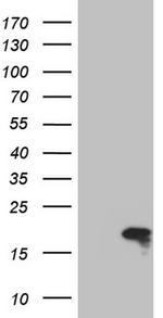 TWIST2 Antibody in Western Blot (WB)