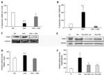 TXNIP Antibody in Western Blot (WB)