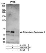 Thioredoxin Reductase 1/TXNRD1/TRXR1 Antibody in Western Blot (WB)