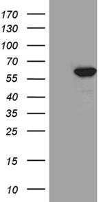 TXNRD1 Antibody in Western Blot (WB)