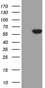 TXNRD1 Antibody in Western Blot (WB)