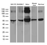 TXNRD1 Antibody in Western Blot (WB)