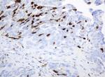 TYMP Antibody in Immunohistochemistry (Paraffin) (IHC (P))